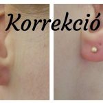 kep_korrekcio_11